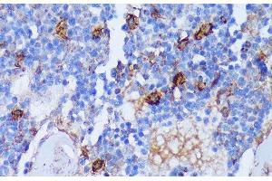 Immunohistochemistry of paraffin-embedded Rat bone marrow using PADI4 Polyclonal Antibody at dilution of 1:100 (40x lens). (PAD4 anticorps)