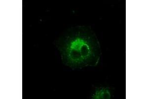 Image no. 6 for anti-Crystallin, alpha B (CRYAB) antibody (ABIN1497644) (CRYAB anticorps)