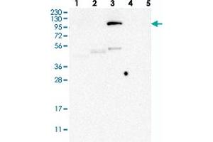 Western blot analysis of Lane 1: RT-4, Lane 2: U-251 MG, Lane 3: Human Plasma, Lane 4: Liver, Lane 5: Tonsil with LEMD3 polyclonal antibody .