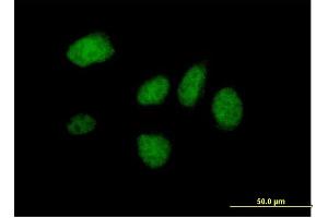 Immunofluorescence of purified MaxPab antibody to DIDO1 on HeLa cell. (DIDO1 anticorps  (AA 1-544))