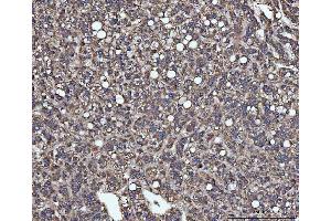 IHC analysis of SLU7 using anti-SLU7 antibody (ABIN7601697). (SLU7 anticorps  (AA 42-474))