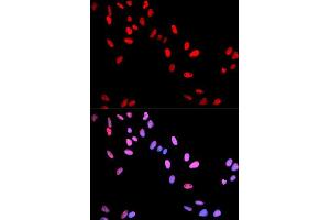 Immunofluorescence analysis of U2OS cell using Phospho-MYC-T58 antibody. (c-MYC anticorps  (pThr58))