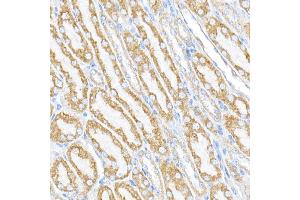 Immunofluorescence analysis of NIH/3T3 cells using RMDN3 Rabbit pAb (ABIN6127274, ABIN6146979, ABIN6146981 and ABIN6221512) at dilution of 1:250 (40x lens). (RMDN3 anticorps  (AA 171-470))