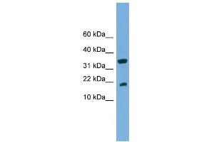 WB Suggested Anti-ACP1 Antibody Titration:  0. (ACP1 anticorps  (Middle Region))