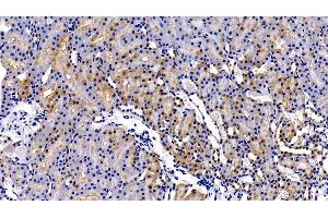 Detection of MMP7 in Rat Kidney Tissue using Polyclonal Antibody to Matrix Metalloproteinase 7 (MMP7)