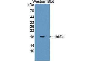 Western blot analysis of the recombinant protein. (PDCD5 anticorps  (AA 2-125))