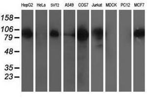 Image no. 4 for anti-Excision Repair Cross-Complementing Rodent Repair Deficiency, Complementation Group 4 (ERCC4) antibody (ABIN1498070)