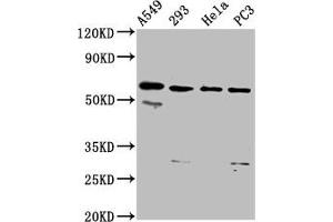 Western Blot Positive WB detected in: A549 whole cell lysate, 293 whole cell lysate, Hela whole cell lysate, PC-3 whole cell lysate All lanes: DDX28 antibody at 6. (DDX28 anticorps  (AA 71-206))