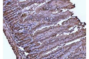 IHC analysis of VCP using anti-VCP antibody (ABIN7599605).