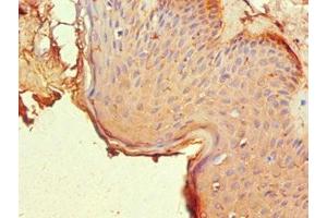 Immunohistochemistry of paraffin-embedded human skin tissue using ABIN7161902 at dilution of 1:100