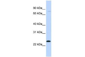 WB Suggested Anti-MX1 Antibody Titration: 0. (MX1 anticorps  (C-Term))