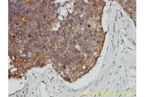 Image no. 2 for anti-Prefoldin Subunit 3 (PFDN3) (AA 1-198) antibody (ABIN466118) (VBP1 anticorps  (AA 1-198))