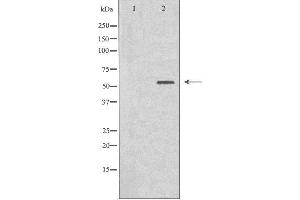 Western blot analysis of extracts from HT-29 cells, using Cytochrome P450 2B6 antibody. (CYP2B6 anticorps  (Internal Region))