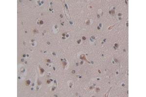 Used in DAB staining on fromalin fixed paraffin- embedded Kidney tissue