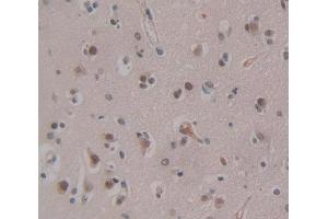 Used in DAB staining on fromalin fixed paraffin- embedded Kidney tissue (CHD5 anticorps  (AA 712-896))