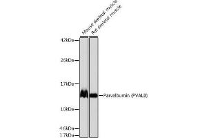 Western blot analysis of extracts of various cell lines, using Parvalbumin (PVALB) (PVALB) antibody (ABIN7269182) at 1:1000 dilution.
