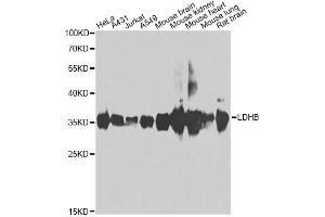 Western blot analysis of extracts of various cell lines, using LDHB antibody (ABIN2563654) at 1:1000 dilution. (LDHB anticorps)