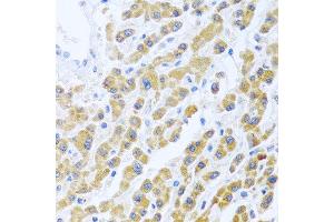 Immunohistochemistry of paraffin-embedded human liver using MANF antibody at dilution of 1:100 (40x lens). (MANF anticorps)