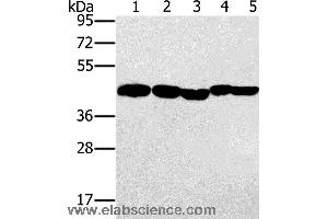Western blot analysis of Hela, skov3 and A549 cell, mouse liver and human ovarian cancer tissue, using PON1 Polyclonal Antibody at dilution of 1:500 (PON1 anticorps)