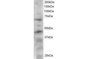 ABIN2560349 staining (2µg/ml) of HeLa lysate (RIPA buffer, 30µg total protein per lane). (TRF1 anticorps  (C-Term))