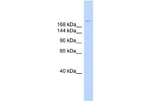 WB Suggested Anti-DYSF Antibody Titration:  0. (Dysferlin anticorps  (N-Term))