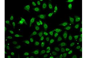 Immunofluorescence analysis of A549 cells using GCA antibody (ABIN5974261). (Grancalcin anticorps)