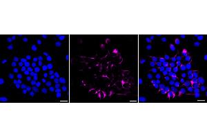 Immunocytochemical staining of HeLa cells with INA antibody (ABIN7799117), 1:1,000). (Recombinant INA anticorps)