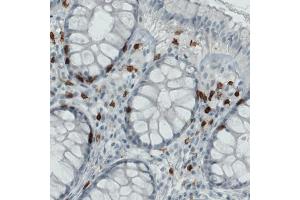 Immunohistochemical staining (Formalin-fixed paraffin-embedded sections) of human rectum with CD3E monoclonal antibody, clone CL1497  shows strong immunoreactivity in a subset of lymphoid cells. (CD3 epsilon anticorps  (AA 25-126))