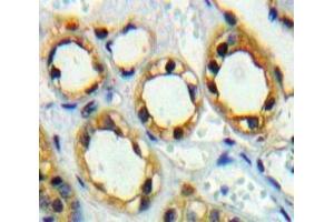 #VALUE! (Adiponectin Receptor 1 anticorps  (AA 1-136))