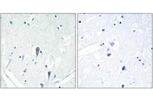 Immunohistochemistry analysis of paraffin-embedded human brain, using IRAK3 Antibody. (IRAK3 anticorps  (AA 491-540))