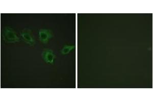 Immunofluorescence analysis of A549 cells, using MYPT1 (Phospho-Thr696) Antibody. (PPP1R12A anticorps  (pThr696))