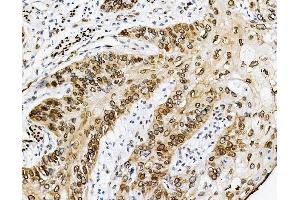IHC analysis of Emerin using anti-Emerin antibody (ABIN4886569). (Emerin anticorps  (N-Term))