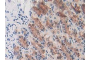 DAB staining on IHC-P; Samples: Rat Stomach Tissue (GSTK1 anticorps  (AA 20-214))