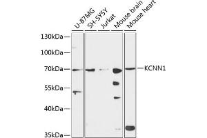 Western blot analysis of extracts of various cell lines, using KCNN1 antibody (ABIN6130514, ABIN6142765, ABIN6142767 and ABIN6224976) at 1:3000 dilution. (KCNN1 anticorps  (AA 1-90))