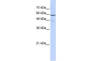WB Suggested Anti-GLUD2 Antibody Titration: 0.