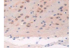Detection of BRCA2 in Mouse Brain Tissue using Polyclonal Antibody to Breast Cancer Susceptibility Protein 2 (BRCA2)