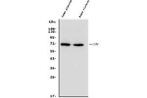 Western blot analysis of ALPP using anti-ALPP antibody (ABIN4886453). (PLAP anticorps  (C-Term))