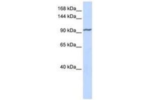 Image no. 1 for anti-Zinc Finger Protein 280D (ZNF280D) (AA 540-589) antibody (ABIN6740450) (ZNF280D anticorps  (AA 540-589))