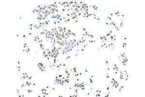 Immunocytochemistry (ICC) image for anti-CCCTC-Binding Factor (Zinc Finger Protein) (CTCF) (AA 650-700) antibody (ABIN7453967) (Recombinant CTCF anticorps  (AA 650-700))