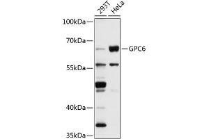 Western blot analysis of extracts of various cell lines, using GPC6 antibody (ABIN1680073, ABIN1680074, ABIN5664142 and ABIN6219786) at 1:1000 dilution. (Glypican 6 anticorps  (AA 320-530))