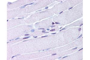 Anti-NUR77 antibody IHC of human skeletal muscle. (NR4A1 anticorps  (AA 251-266))