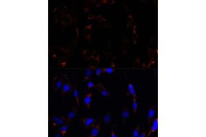 Immunofluorescence analysis of C6 cells using RPL26 antibody (ABIN7269999) at dilution of 1:100.