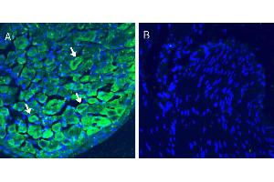 anti-Calcitonin Receptor-Like (CALCRL) (AA 127-140), (Extracellular), (N-Term) antibody