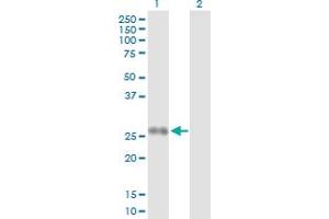 Western Blot analysis of PPP2R3B expression in transfected 293T cell line by PPP2R3B MaxPab polyclonal antibody. (PPP2R3B anticorps  (AA 1-176))