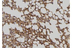 ABIN6275055 at 1/100 staining Mouse lung tissue by IHC-P. (DHRS4 anticorps  (C-Term))