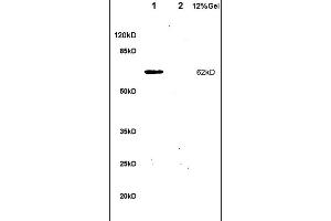 Formalin-fixed and paraffin embedded rat colitis labeled with Anti-IL-1R1/CD121a/IL1 Receptor I Polyclonal Antibody, Unconjugated (ABIN747743) at 1:200 followed by conjugation to the secondary antibody and DAB staining.