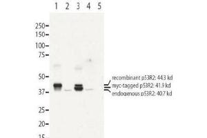 Image no. 1 for anti-Ribonucleotide Reductase M2 B (TP53 Inducible) (RRM2B) (N-Term) antibody (ABIN401481) (RRM2B anticorps  (N-Term))