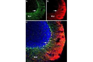 Multiplex staining of KV1.