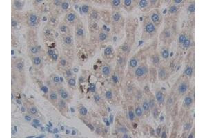 Detection of HPSE in Rat Liver Tissue using Polyclonal Antibody to Heparanase (HPSE) (HPSE anticorps  (AA 40-188))