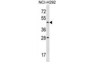 Western Blotting (WB) image for anti-Actin-Like 7b (Actl7b) antibody (ABIN2998793) (Actl7b anticorps)